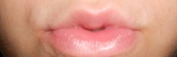 lips