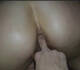 Anal