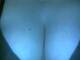 Seno1