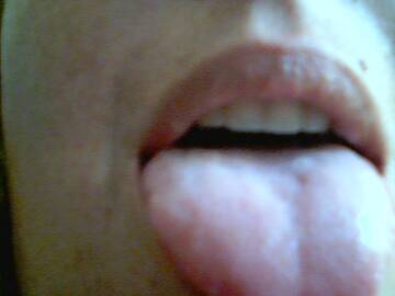 SLURP