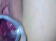 mi apre la fica con lo speculum